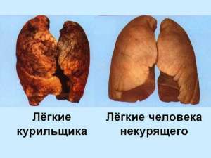 Влияние курения на дыхательную и кровеносную системы