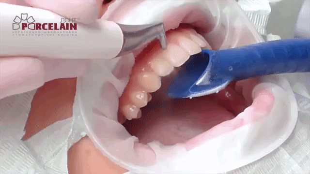 гифка чистка зубов