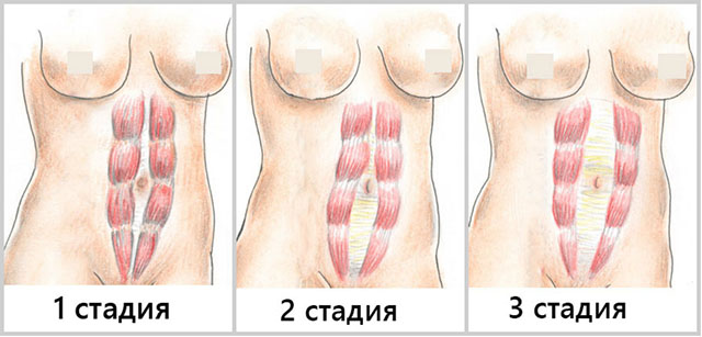 когда необходима операция