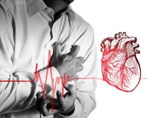 Признаки проявления инфаркта миокарда