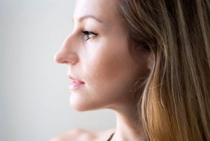 ринопластика: уменьшение размера носа
