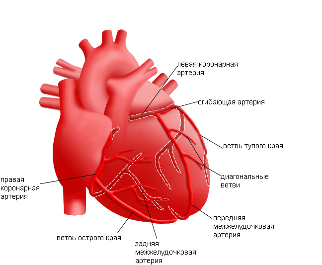 Трансмуральный инфаркт 
