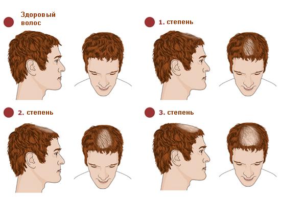 Какими должны быть волосы у мужчин