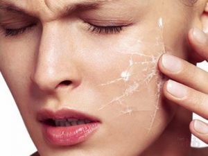 причины шелушения кожи лица