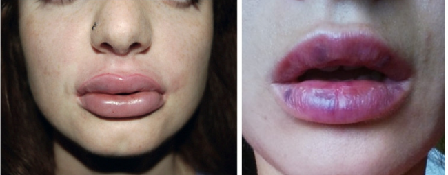 парижские губы
