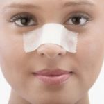 методика проведения операции при переломе носа
