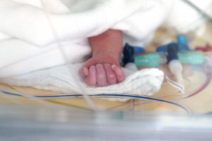 Аневризма межпредсердной перегородки у новорожденных