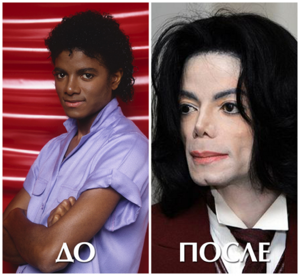 Майкл Джексон подбородок
