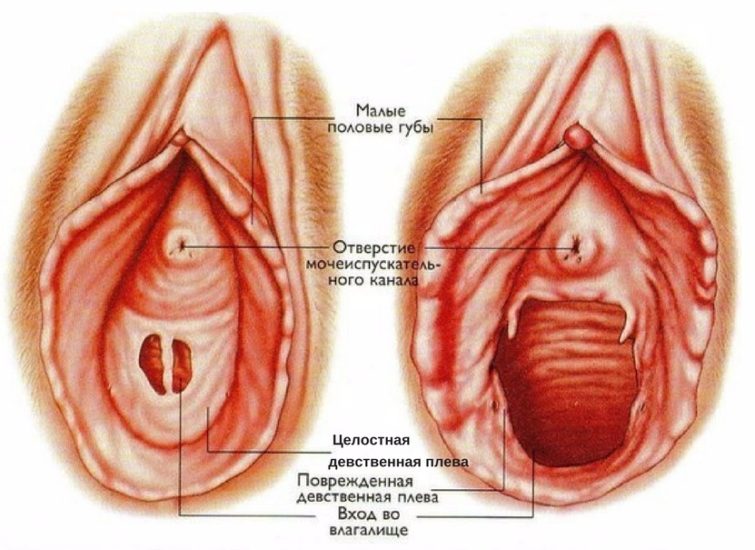 анатомия девственной плевы