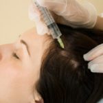 методика проведения мезотерапии волос