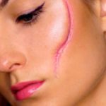 варианты удаления шрамов на лице